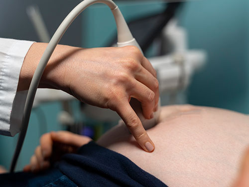 Ecodopplercardiograma Fetal